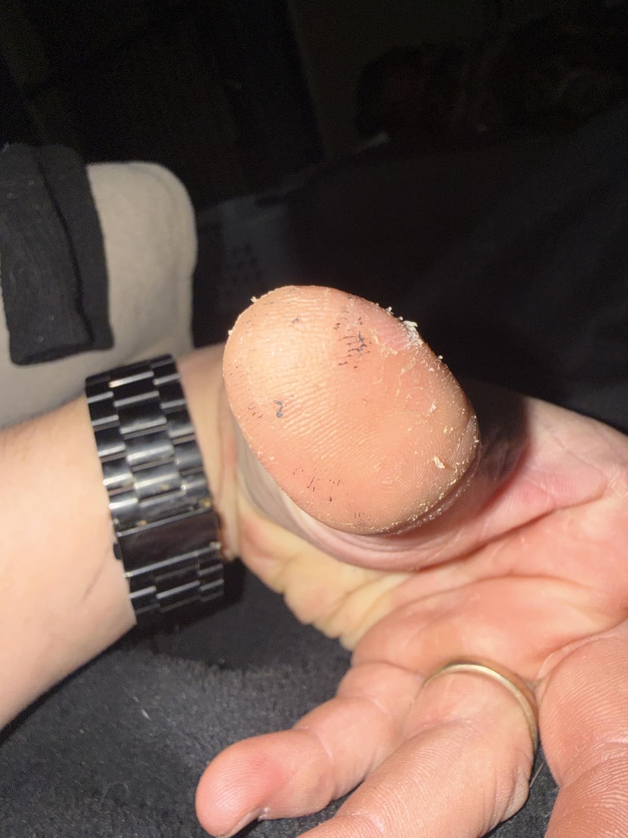 Chrome S Pro iGel YTX14-BS Maintenance-Free, 210CCA, LCD Voltage Display, 12V 16Ah Battery Replacement for ATV, Motorcycle, Jet Skis, Scooter, UTV, and More - Nut and Bolt (T3) Terminal customer photo 2